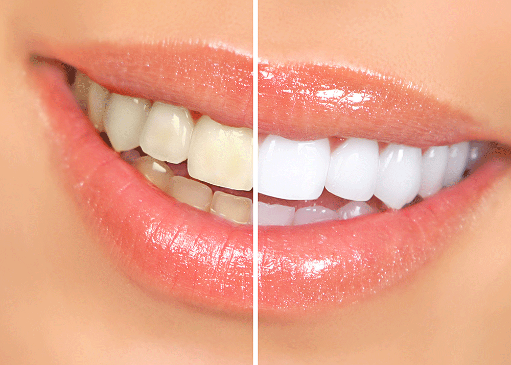 Digital Smile Design & Treatment Planning